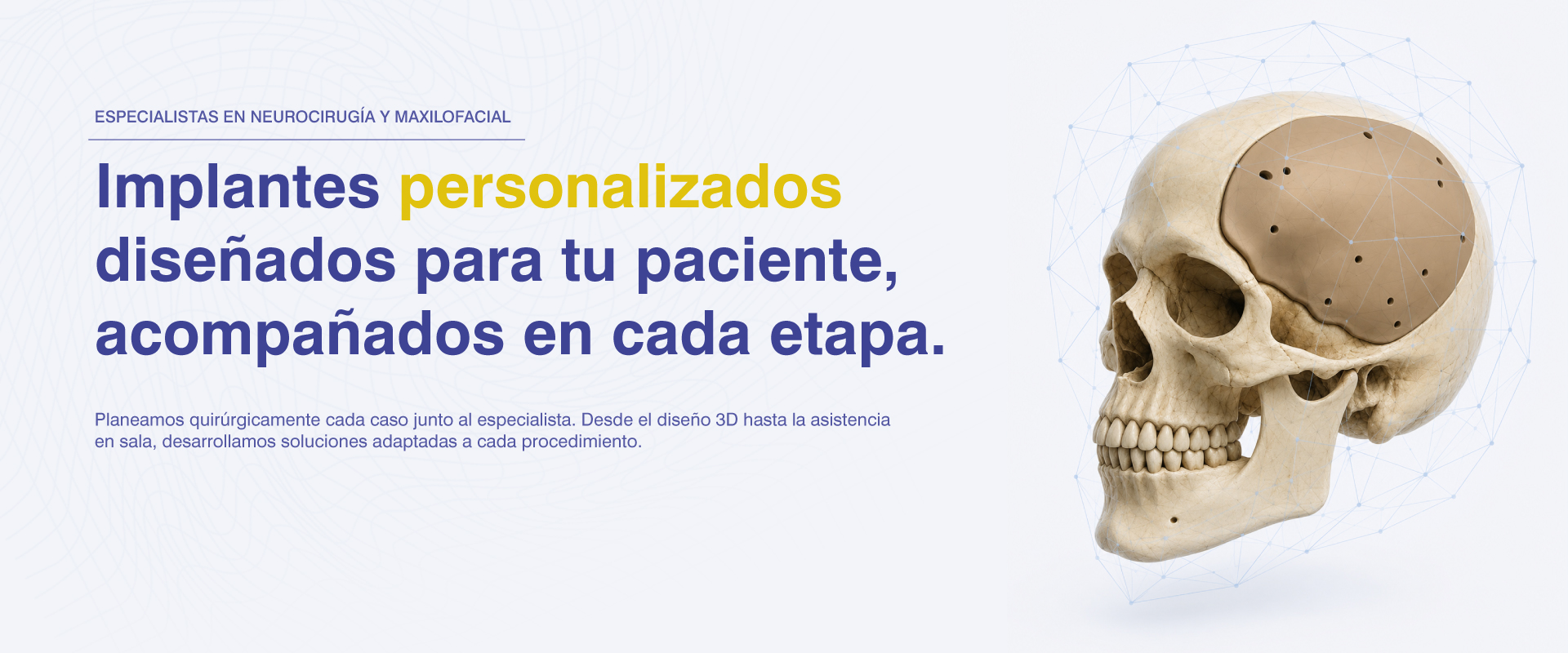 Implantes ortopédicos craneomaxilofaciales