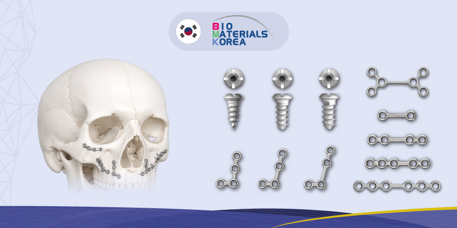 Sistema 1.5 de osteosíntesis maxilofacial
