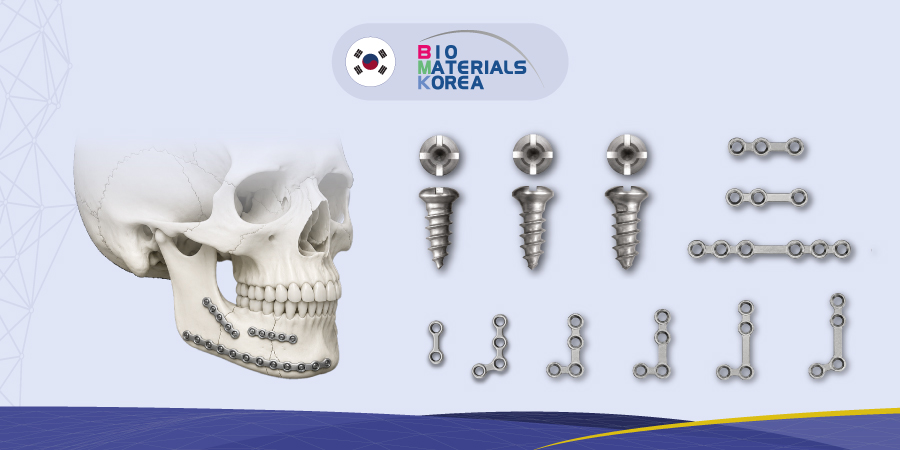 Sistema 2.0 de osteosíntesis maxilofacial